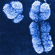 X-chromosome and Y-chromosome